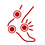 Neuropatía Periférica